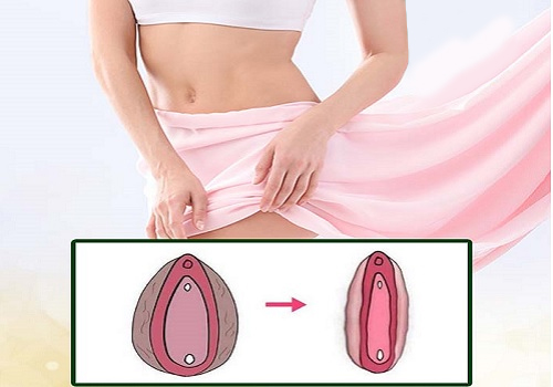 Thẩm mỹ cô bé – Giải pháp giúp chị em trẻ hóa và nâng cao chất lượng cuộc sống