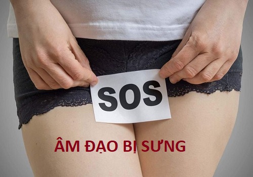 Âm đạo bị sưng là mắc bệnh gì? Bác sĩ chỉ cách điều trị mau khỏi?