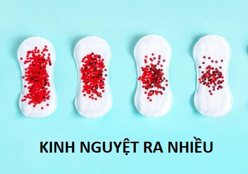Kinh nguyệt ra nhiều phải làm sao? Bác sĩ phụ khoa giải đáp từ A-Z