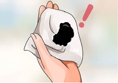 Máu kinh màu đen là bệnh gì? Có nguy hiểm không? Khi nào cần gặp bác sĩ?