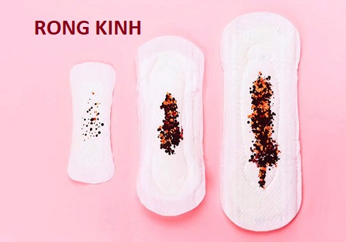 Rong kinh có nguy hiểm không? Làm sao để khắc phục tình trạng này?